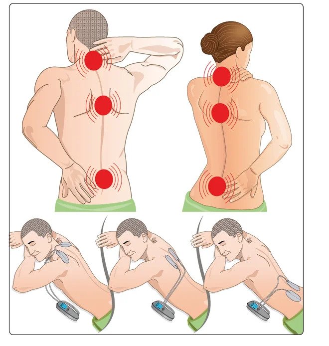 VEINOPLUS® BACK